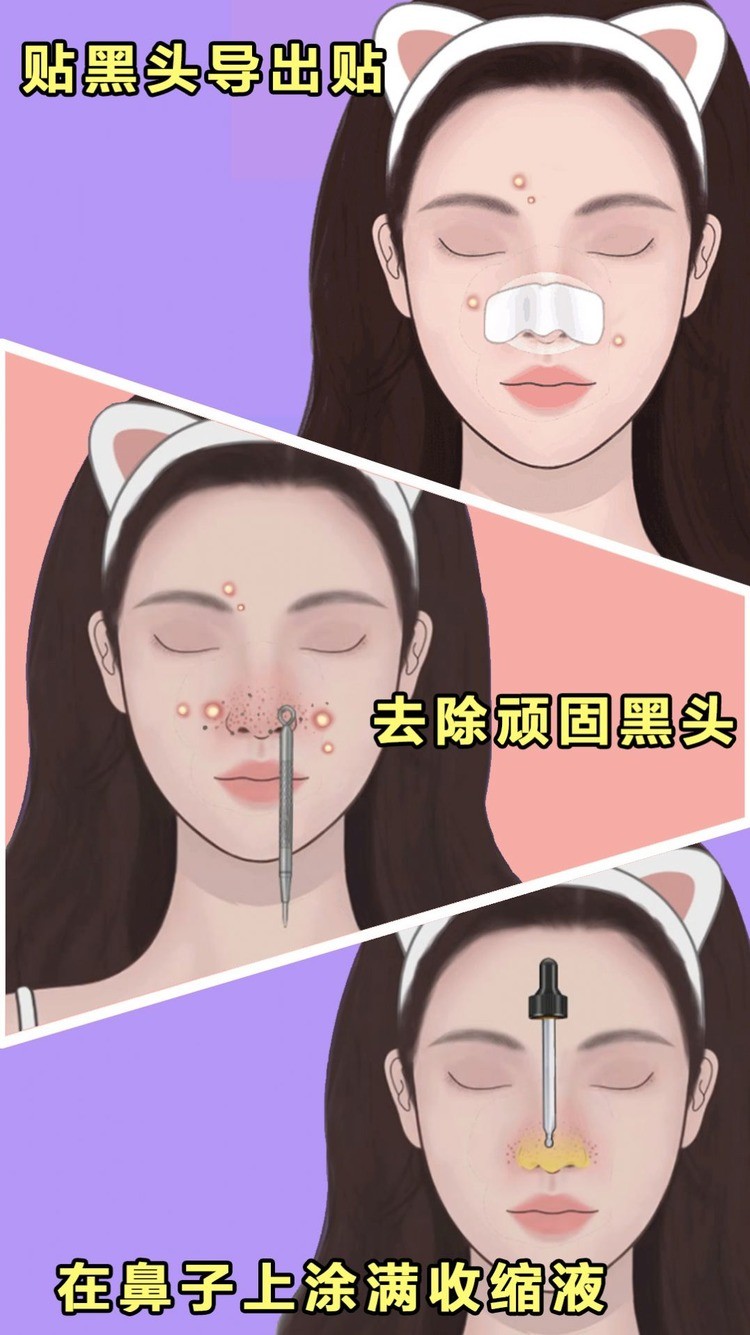 ʽѹױϷ